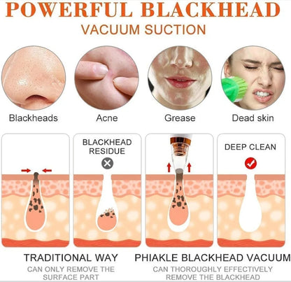 4 In 1 Multi-Function Blackhead and Whitehead Remover