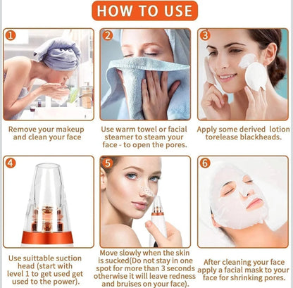 4 In 1 Multi-Function Blackhead and Whitehead Remover