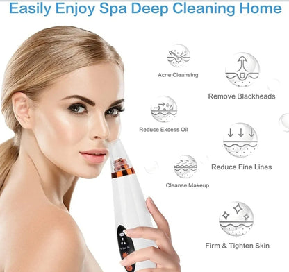 4 In 1 Multi-Function Blackhead and Whitehead Remover